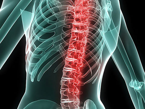 X-ray complete back image at Complete health physio